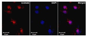 DNA/RNA Damage